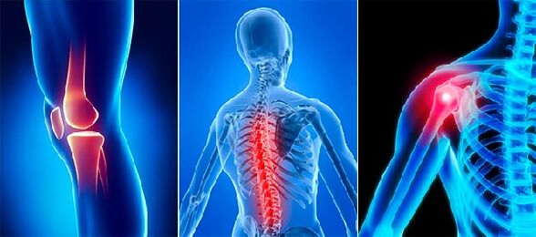 Articulum Pain in Arthrosis