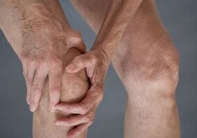 How osteoarthritis of the knee joint manifests itself